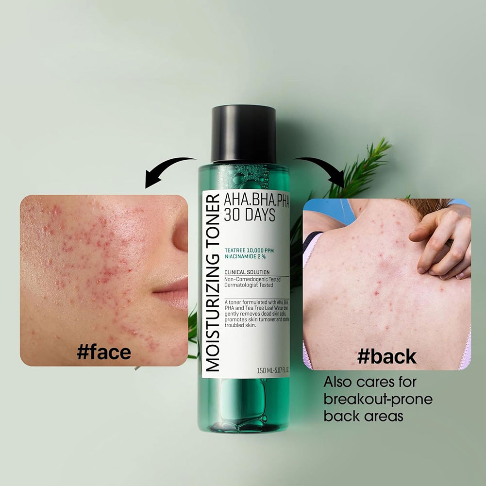 Some by Mi Aha.Bha.Pha 30 Days – обзор и цена Skincare Some By Mi