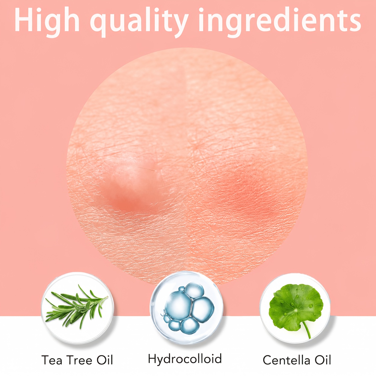 Набор невидимых пластырей от п – обзор и цена Skincare Gentle